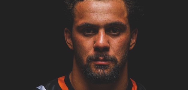 Screw loose: Aloiai searching for stability after radical hand surgery